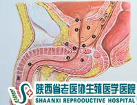 精索靜脈曲張的檢查都有什么