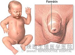 ˰Ƥ^(gu)L(zhng)ôkź